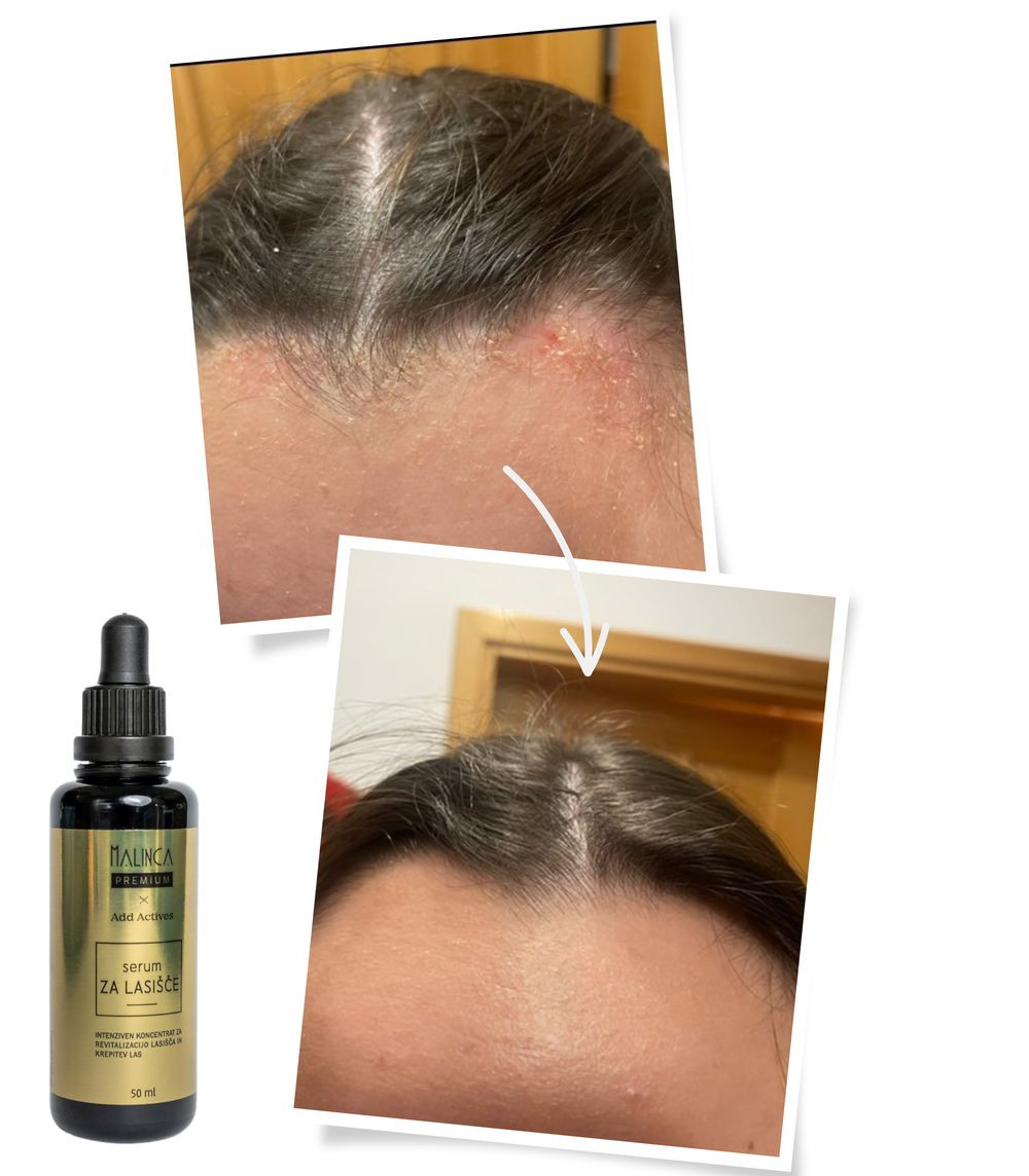 Serum za vlasište 50 ml
